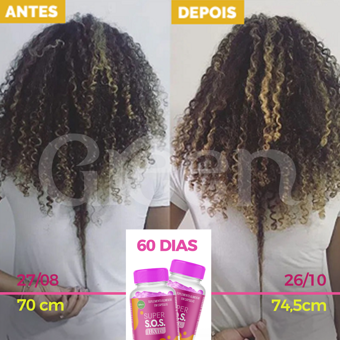 CRIATIVO-SOS-HAIR-03.png